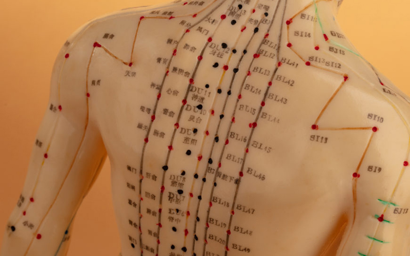 Bangalore Acupuncture Specialists