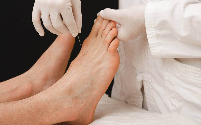 Professional Acupuncturists Bangalore