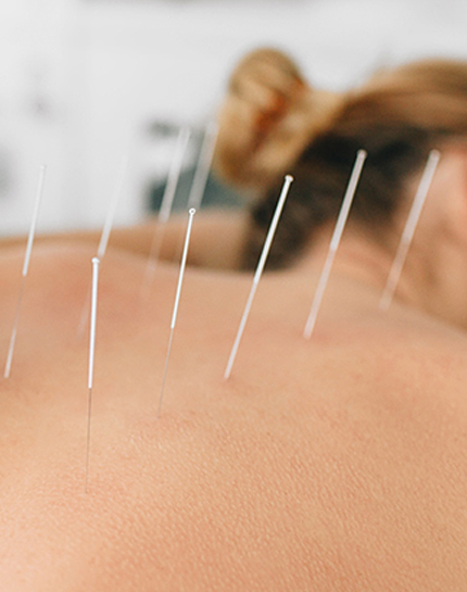 Bangalore Acupuncture Specialists