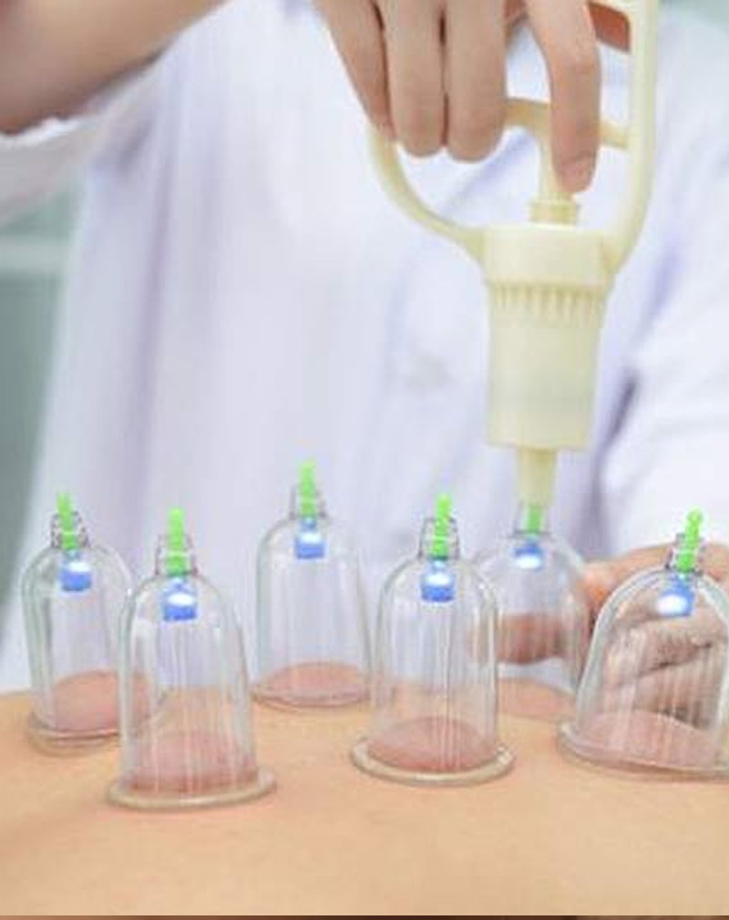 Cupping Therapy Centre in RR Nagar