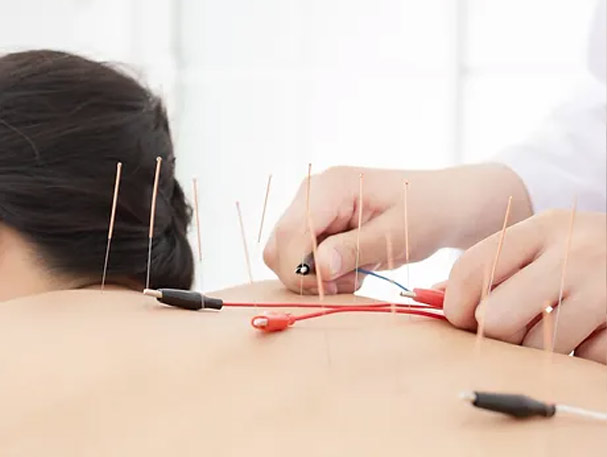Electro Acupuncture Clinic in RR Nagar