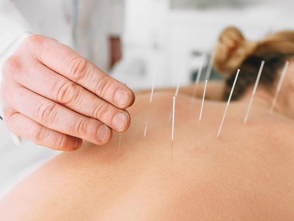 Acupuncture Health Centre RR Nagar