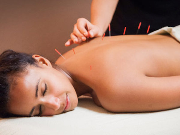 Holistic Acupuncture RR Nagar