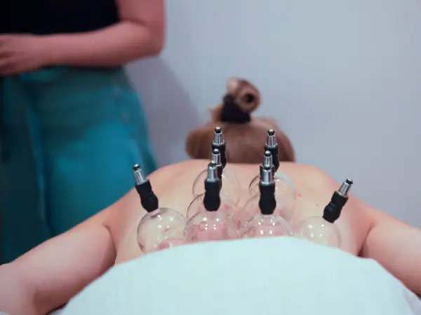 Expert Acupuncture Services Bangalore