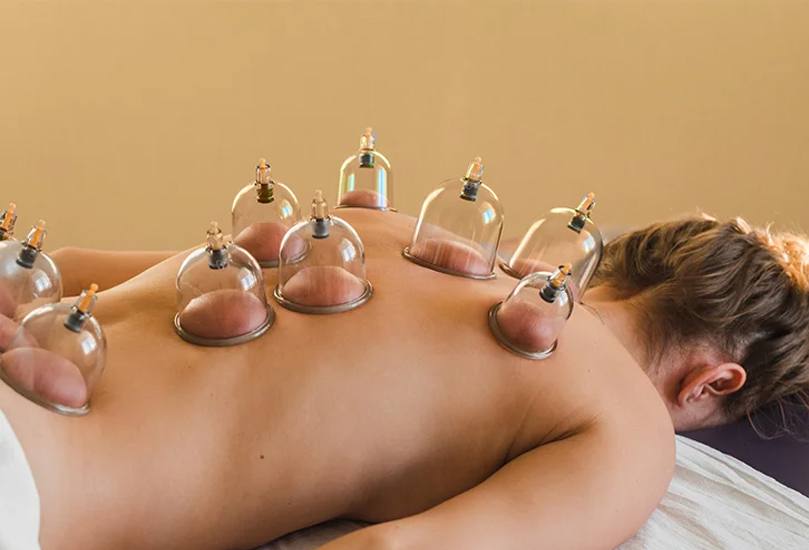 Cupping Therapy in Bangalore